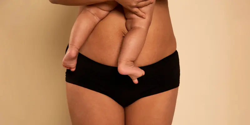 ankara annelik estetiğii